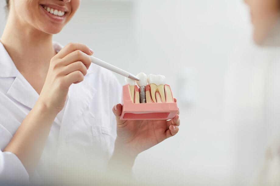 Dental Implant Financing Options